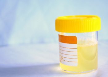 infeccao-urinaria-saude-brasilia-cistite