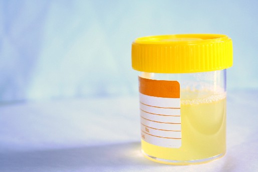 infeccao-urinaria-saude-brasilia-cistite