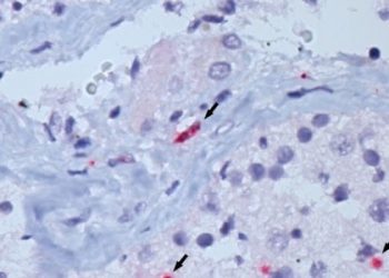 coronavirus-covid-19-testículos-espermatozoides-estudo-usp-saude-brasilia