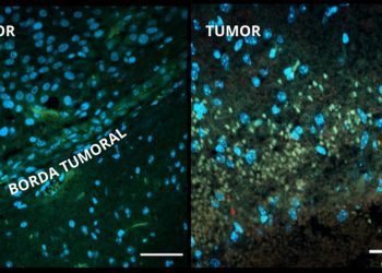 Tratamento com injeções de vírus zika destrói tumor cerebral em camundongos sem causar lesão neurológica