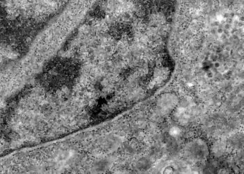 variante-omicron-saúde-brasília