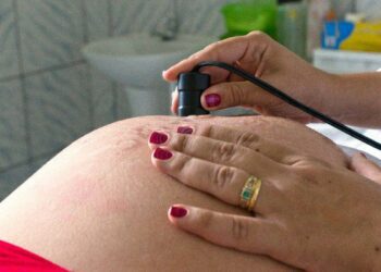ANS lança campanha contra cesarianas desnecessárias