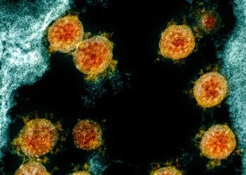 Estudo da Fiocruz em parceria com Harvard explica inflamação excessiva da covid-19