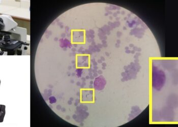 Inteligência artificial permite detectar doença de Chagas usando imagens de celular
