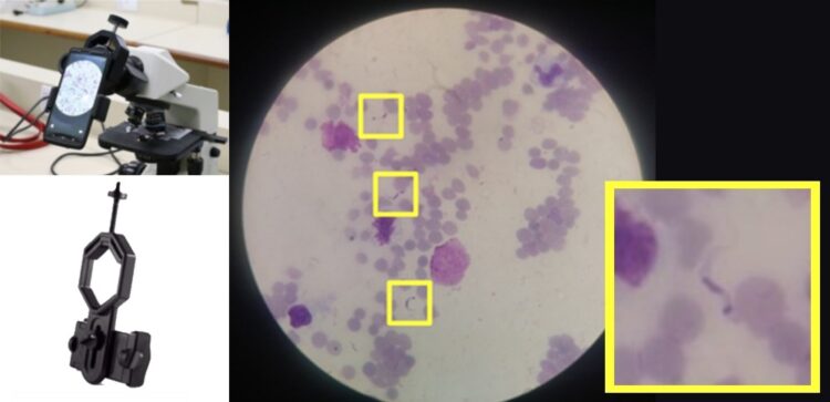 Inteligência artificial permite detectar doença de Chagas usando imagens de celular